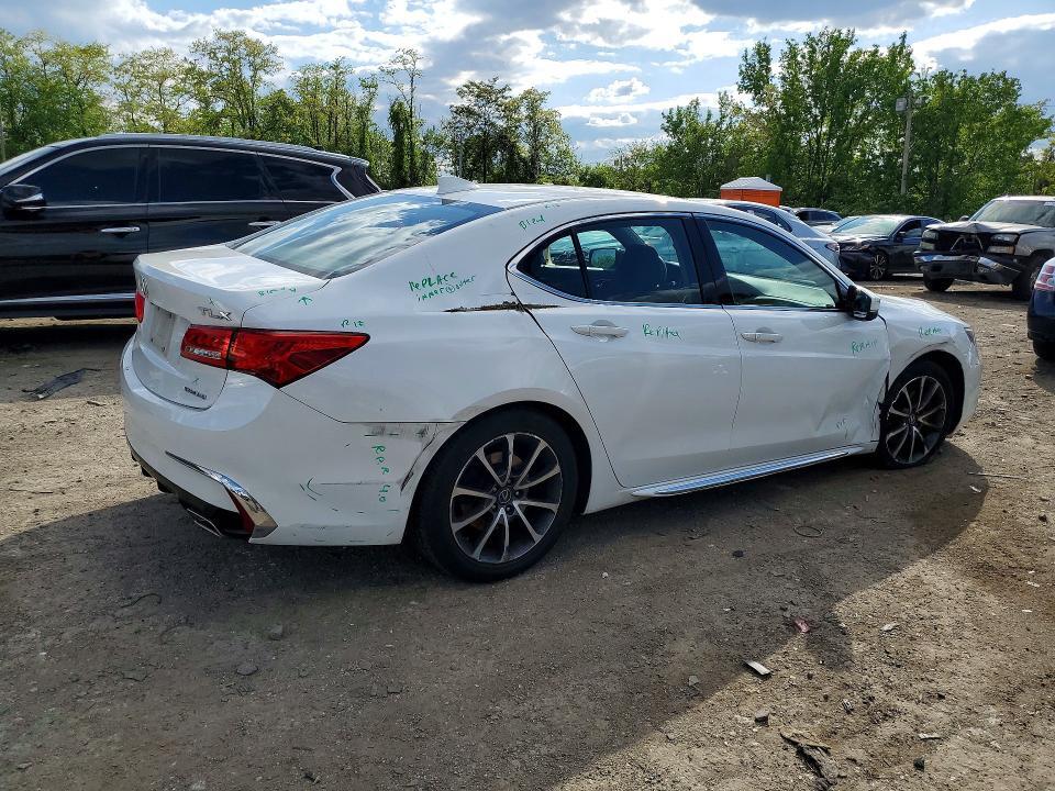 2018 ACURA TLX TECH — Фото 3 из 12