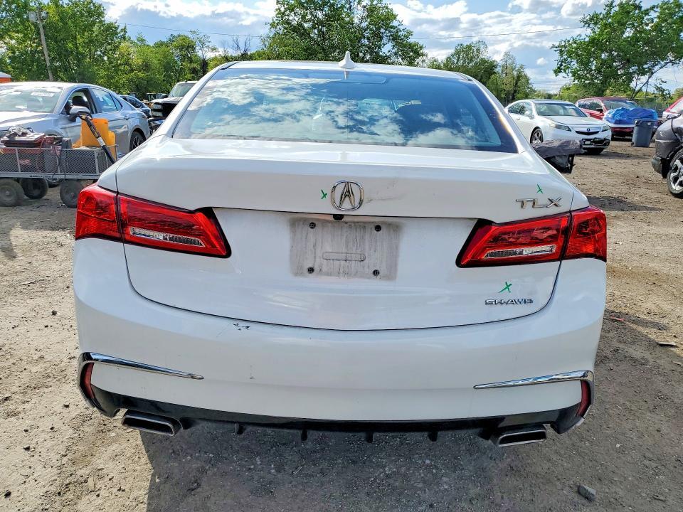 2018 ACURA TLX TECH — Фото 6 из 12