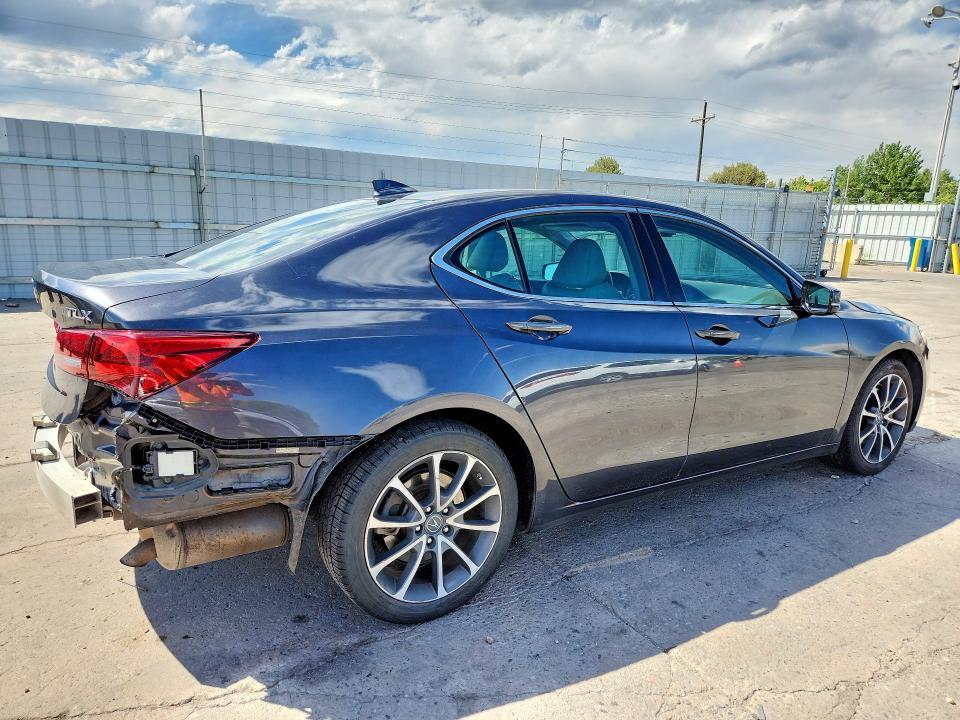 2015 ACURA TLX TECH — Фото 3 из 13