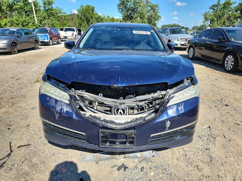 2015 ACURA TLX TECH — Фото 5 из 12