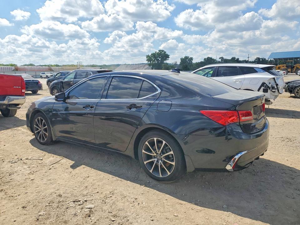 2020 ACURA TLX — Фото 2 из 12