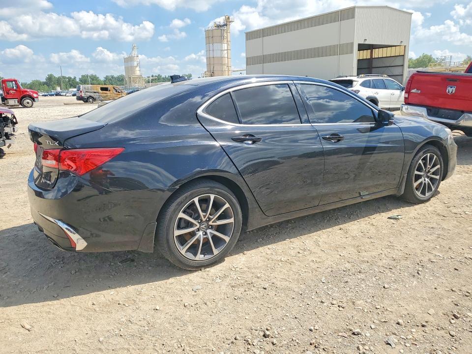 2020 ACURA TLX — Фото 3 из 12