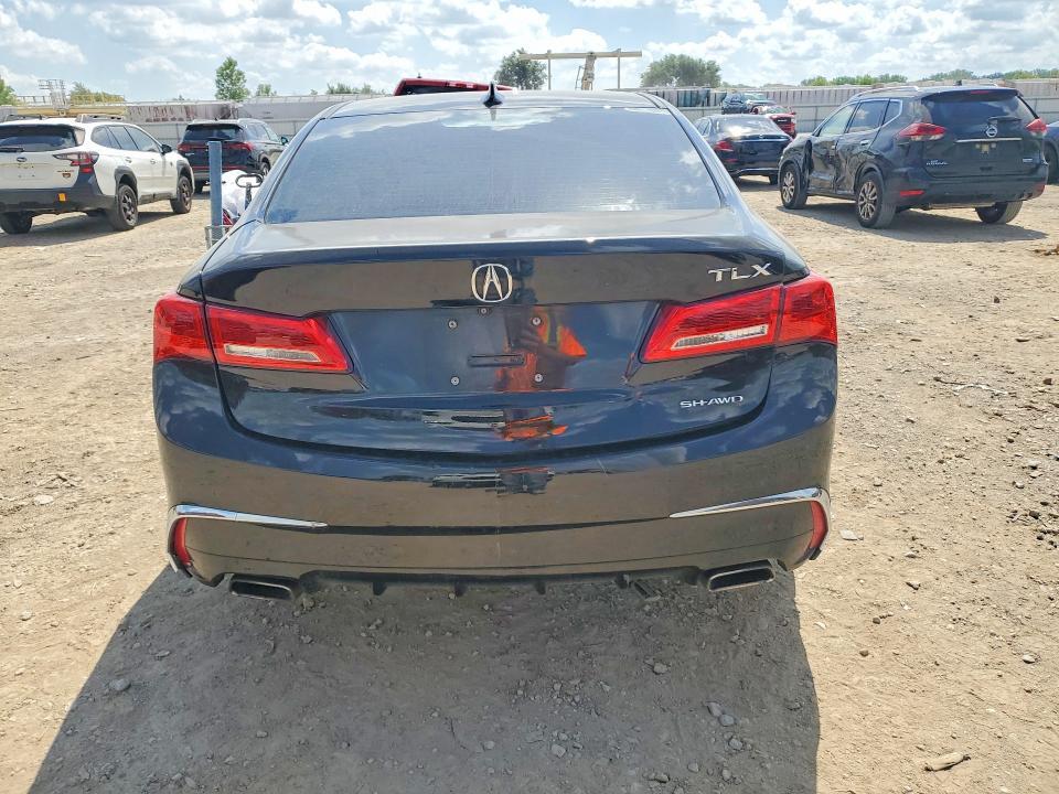 2020 ACURA TLX — Фото 6 из 12