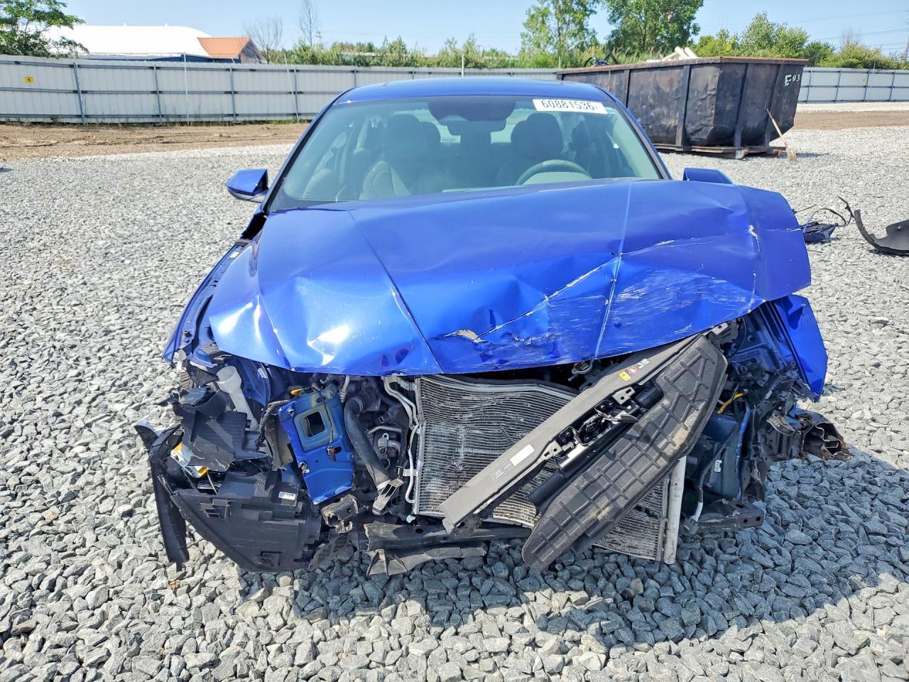 KMHLS4DGXRU647013 2024 HYUNDAI ELANTRA photo no. 5