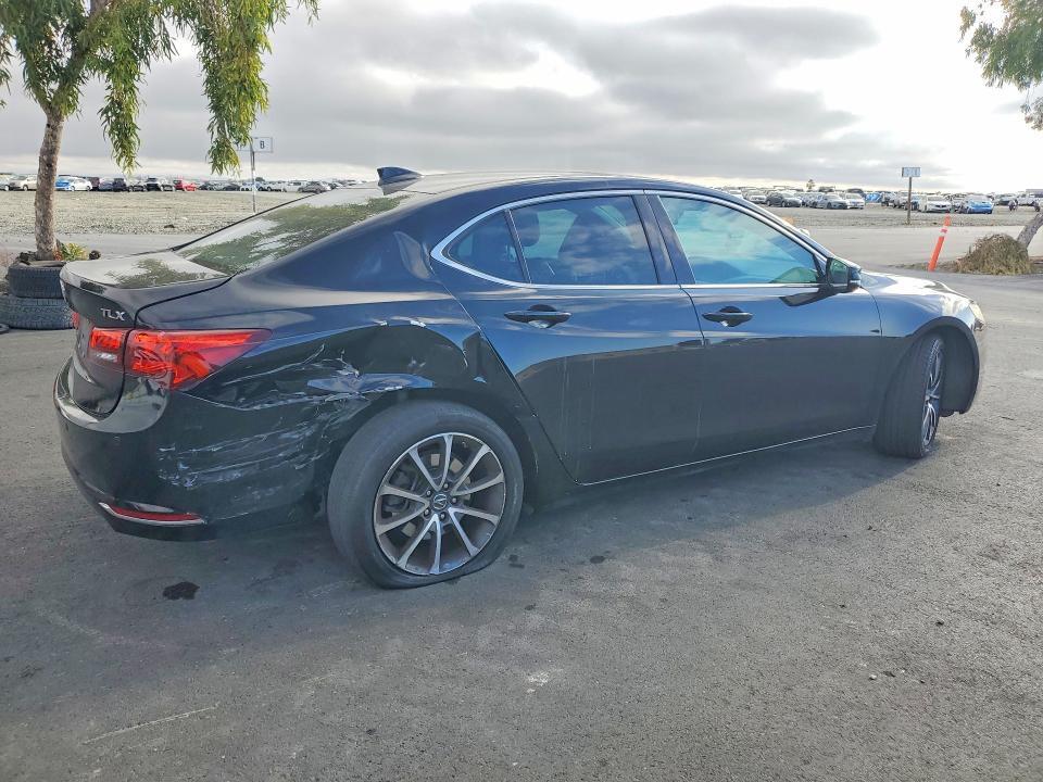 2015 ACURA TLX ADVANCE — Фото 3 из 14