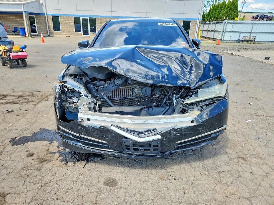 2016 ACURA TLX — Фото 5 из 14