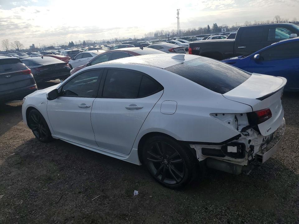 2020 ACURA TLX TECHNOLOGY — Фото 2 из 13