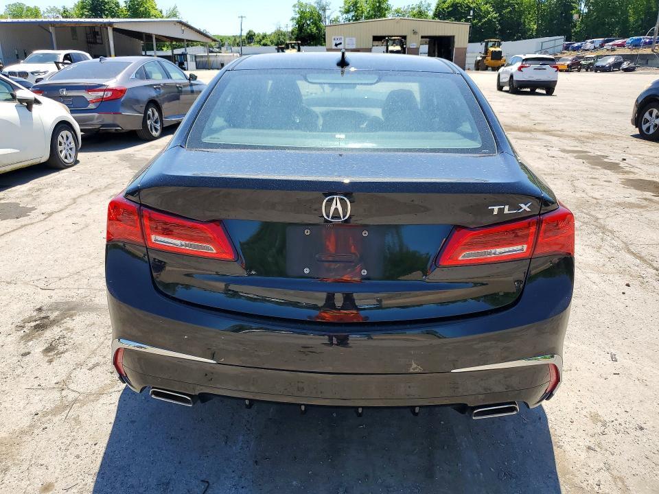 2020 ACURA TLX TECHNOLOGY — Фото 6 из 12
