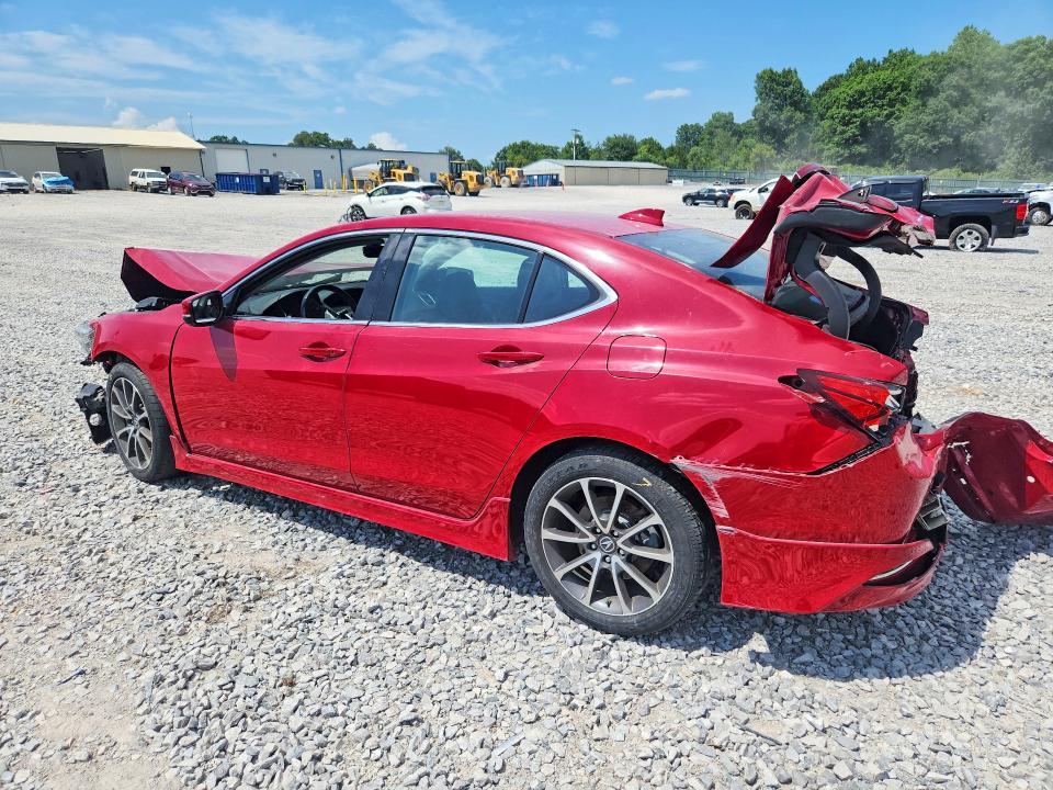 2017 ACURA TLX ADVANCE — Фото 2 из 13