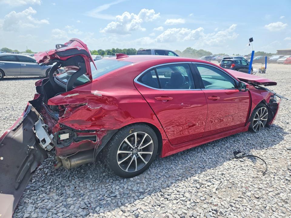 2017 ACURA TLX ADVANCE — Фото 3 из 13
